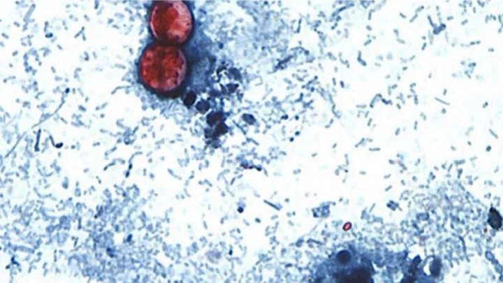 Cyclosporiasis outbreak linked to shredded lettuce served at some Taco Bell locations: CDC, FDA