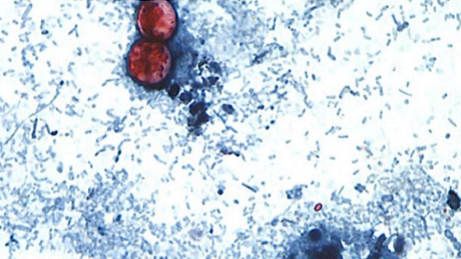 Cyclosporiasis outbreak linked to shredded lettuce served at some Taco Bell locations: CDC, FDA