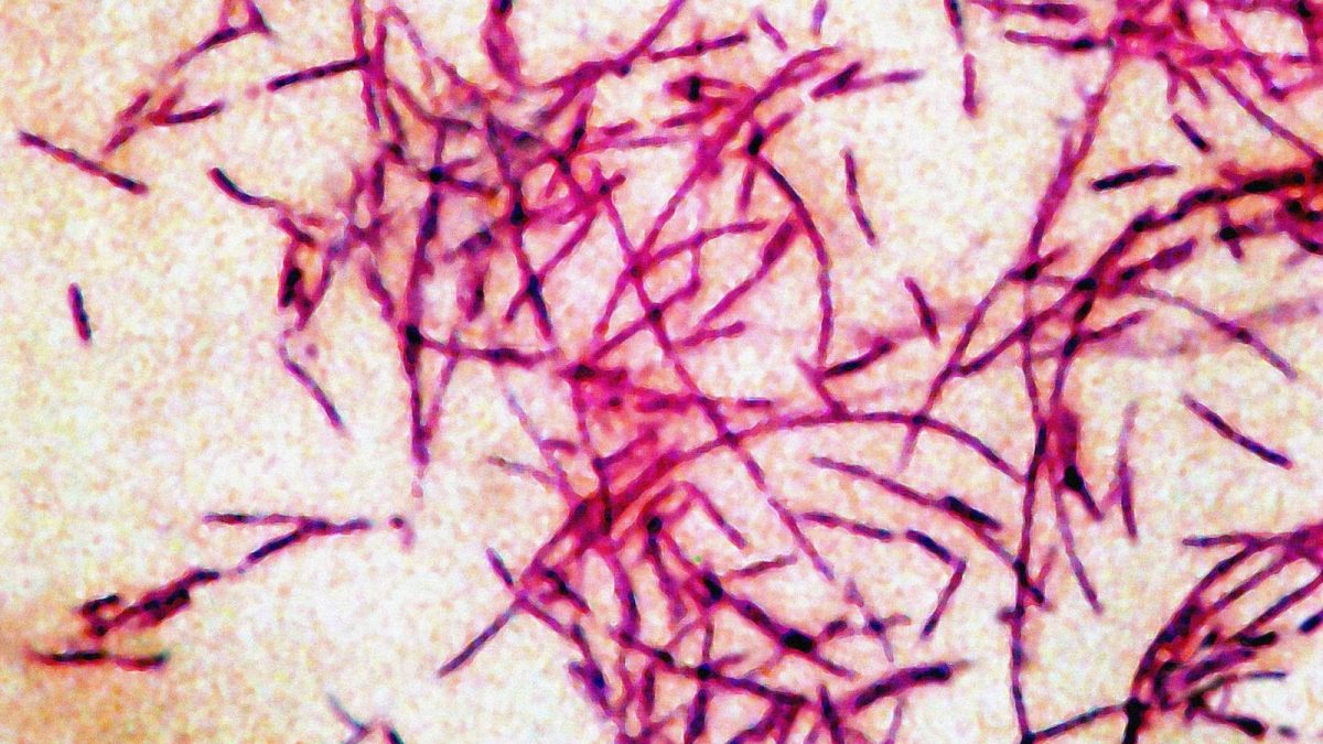 legionnaires-disease-stock-gty-jef-191021_hpMain_3_16x9