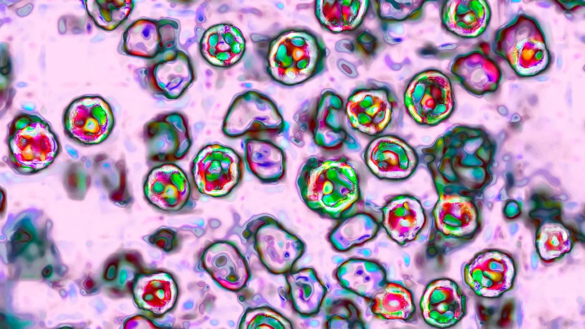 Another measles-related death reported in Pennsylvania as outbreak grows